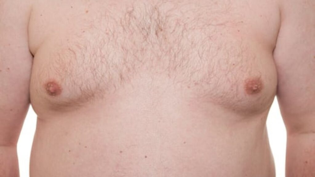 how to lose chest fat